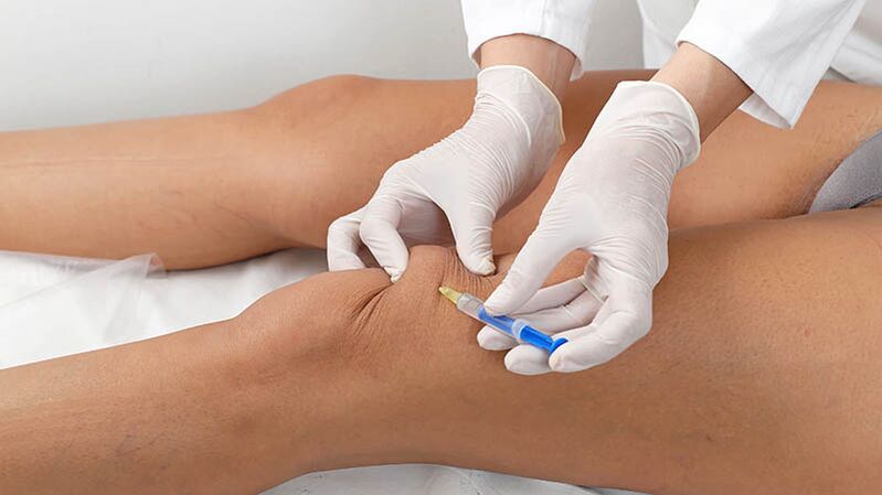 Injection intra-articulaire pour l'arthrose du genou